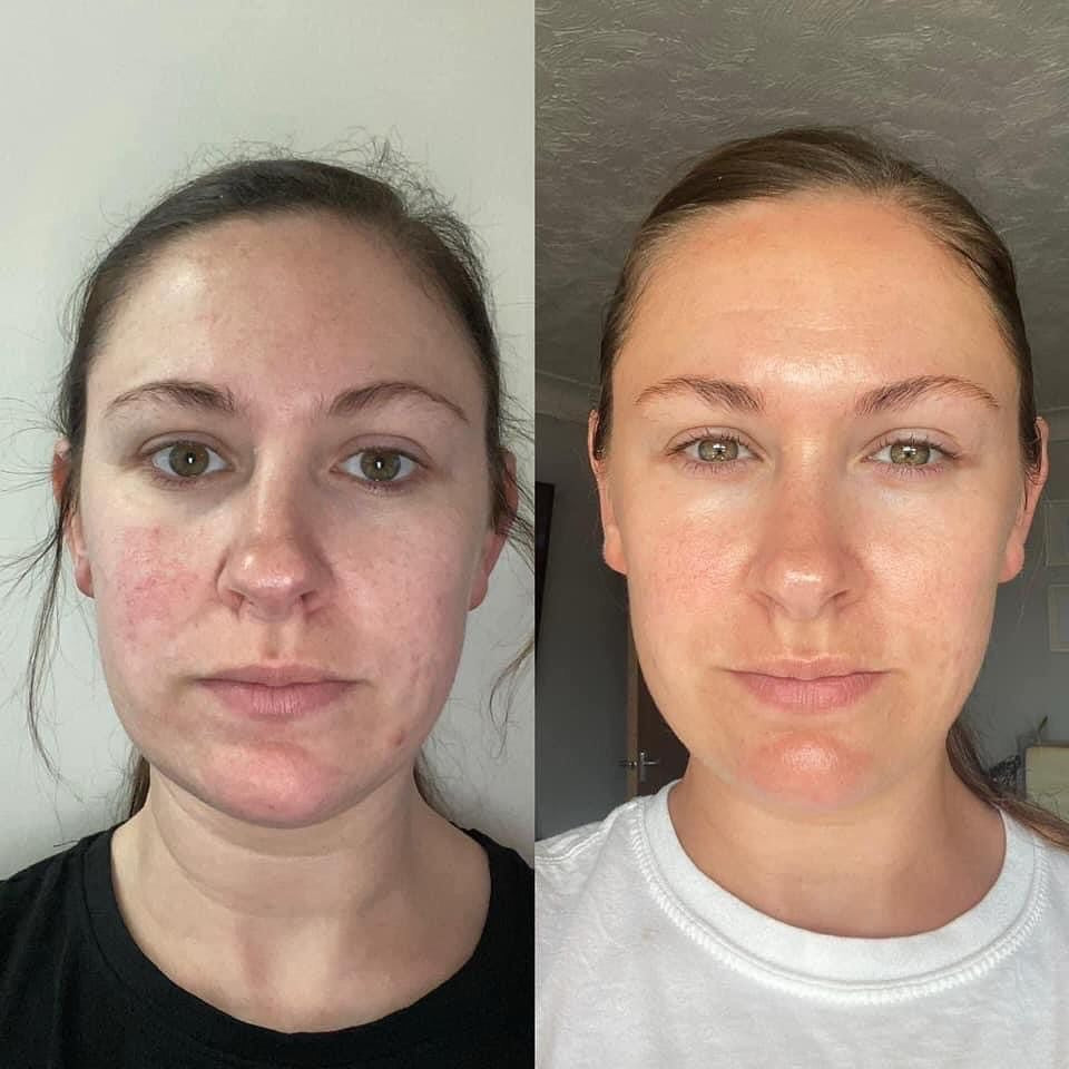 Turmeric & Kojic Acid Brightening Pads