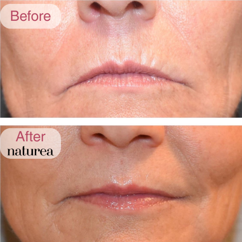 Collagen Volume Balm