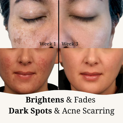 Turmeric & Kojic Acid Brightening Pads