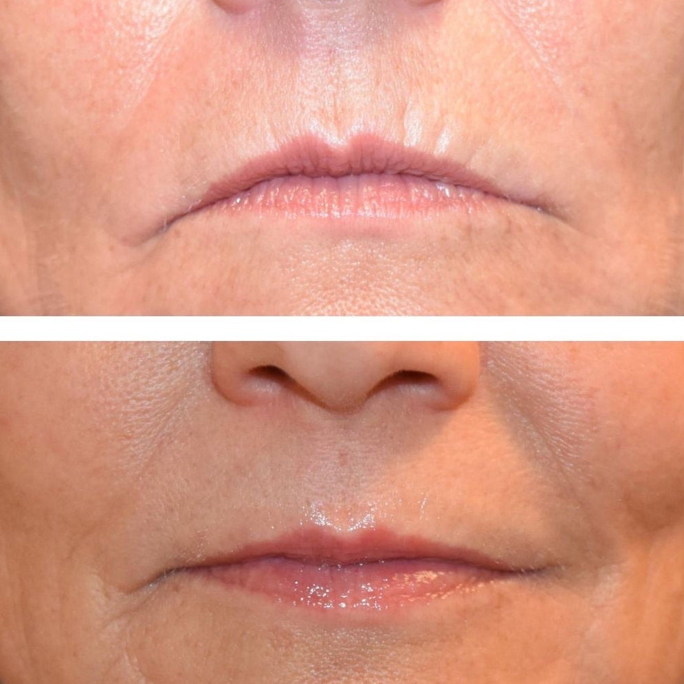 <h2>Hear from women who were <em>skeptical</em>, too</h2>